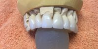 Nutzerfoto 1 Brüstl Gerd Dentallabor Zahntechnik