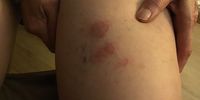 Nutzerfoto 2 Dermatologische Privatpraxis Dr. med. Löser-Vincze