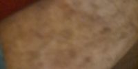 Nutzerfoto 1 Zedlitz Sven Dr.med. Hautarzt und Allergologie