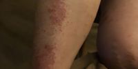 Nutzerfoto 1 Dermatologische Privatpraxis Dr. med. Löser-Vincze