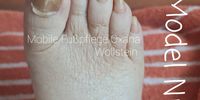 Nutzerfoto 12 Wollstein Oxana Mobile Fußpflege