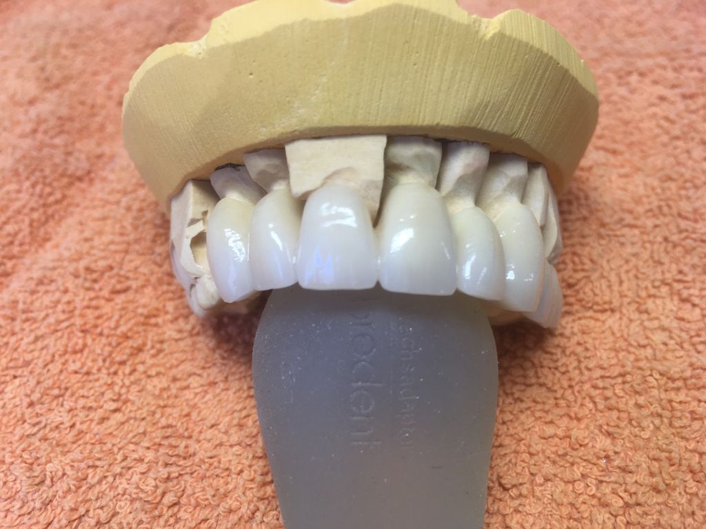 Nutzerfoto 1 Brüstl Gerd Dentallabor Zahntechnik