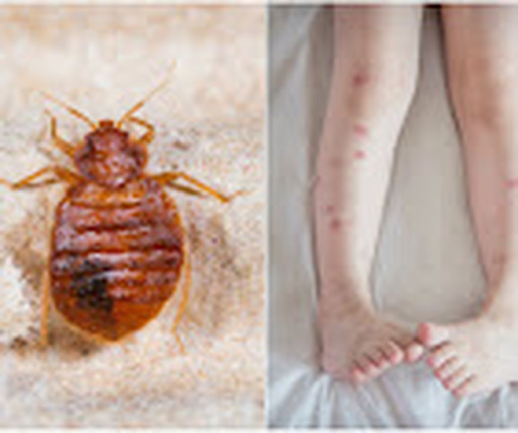 Nutzerfoto 12 Kammerjäger ELF Nutzerfoto 12 Kammerjäger ELF